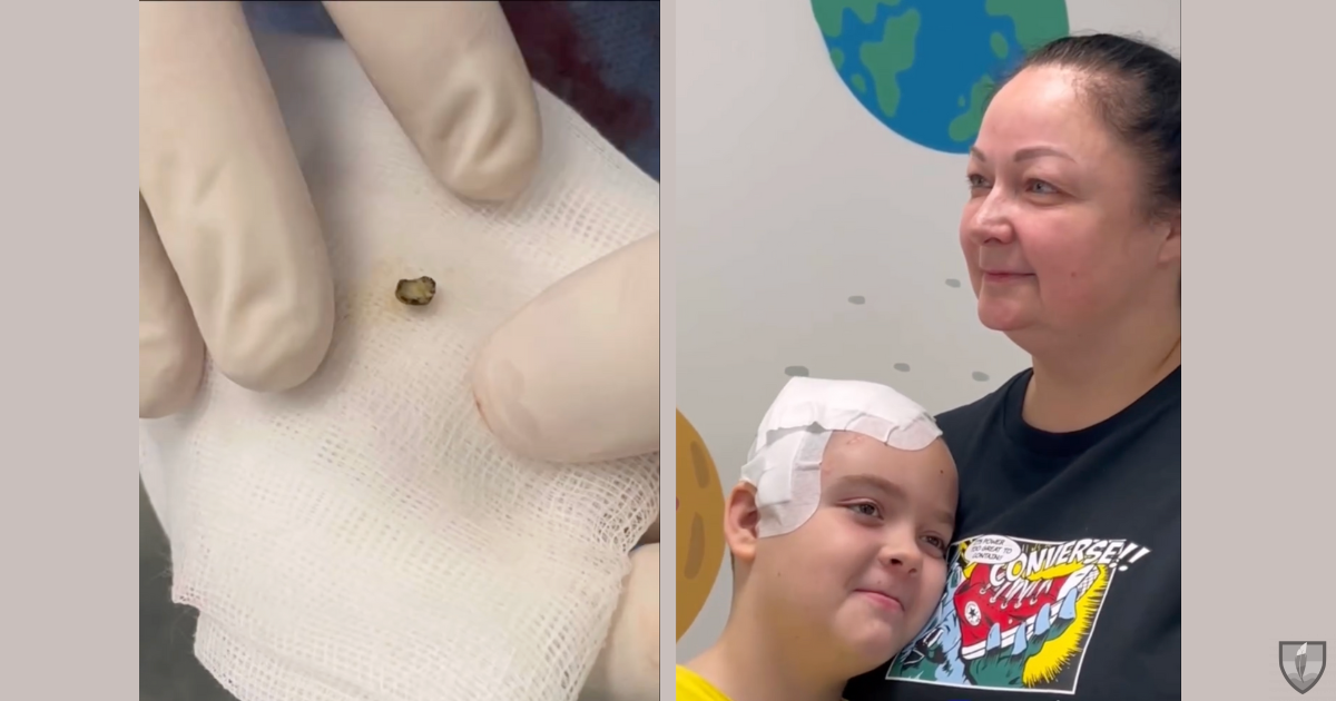 Фрагмент от руска мина се заби в мозъка на 9-годишния Михайлик от Херсон